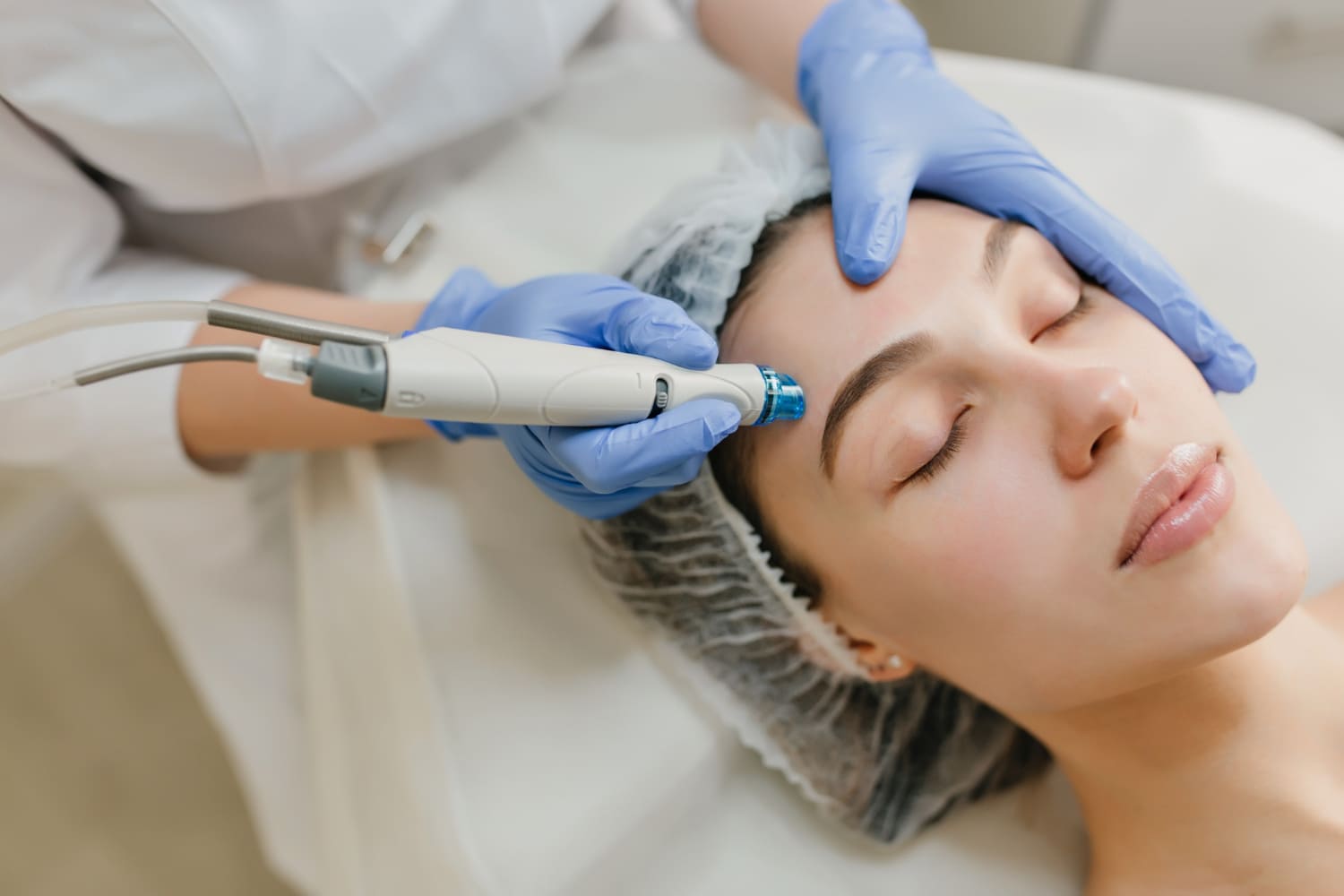 Melasma: Why It Keeps Coming Back &amp; What Actually Works